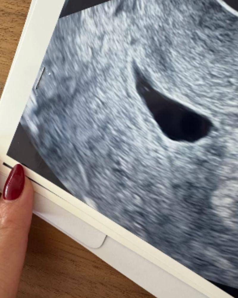 Instagram.com/nikitawillyofficial94